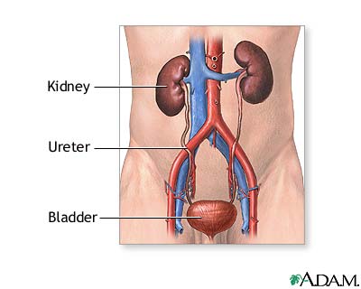 The number one cause of kidney failure in the world is diabetes.