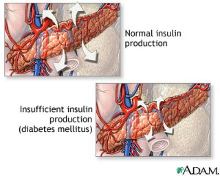 Insulin is made by the pancreas.