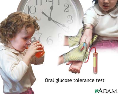 Oral glucose tolerance test (OGTT)