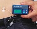 An insulin pump is a deviced used to administer insulin without the need for shots. An insulin pump is a deviced used to administer insulin without the need for shots.