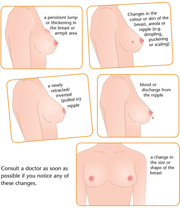 Symptoms of Breast Cancer - Image Health-Beauty-Care.org