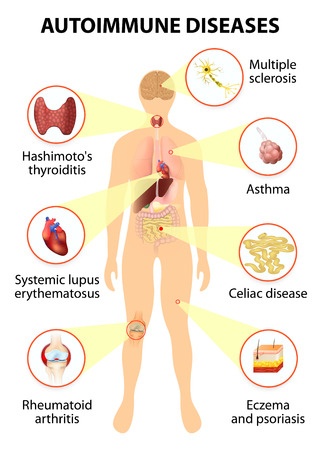 Metabolic Disorders