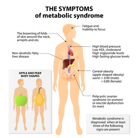 Signs and Symptoms of Metabolic Syndrome