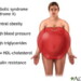 Diabetes Statistics for the United States