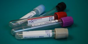 Definition: Fasting Blood Glucose Test Ranges