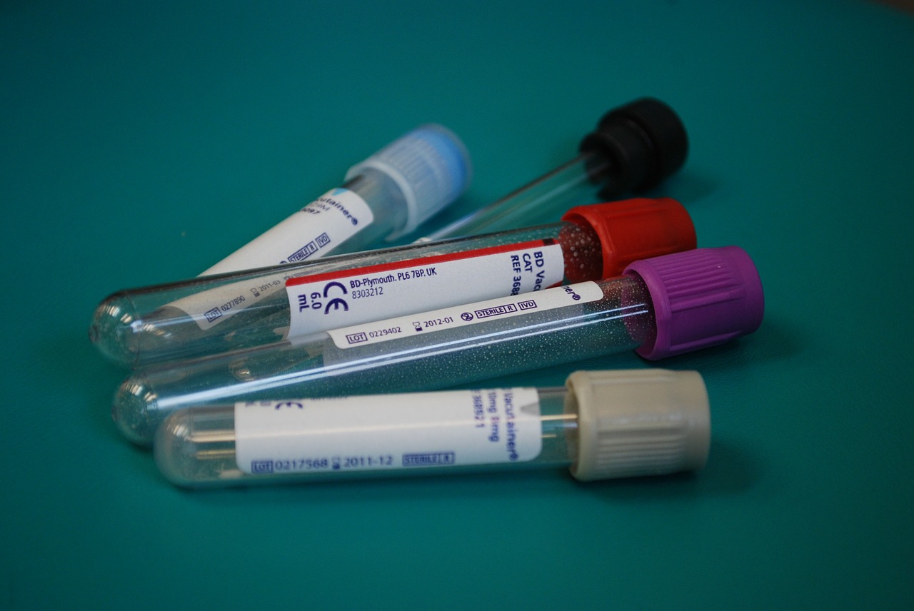 Blood Draws for Prediabetes Check
