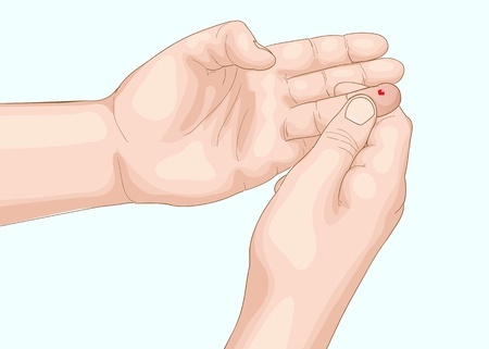 Step 2. Get a blood droplet big enough to feed into the test strip. Different meters require different sizes of blood drops.