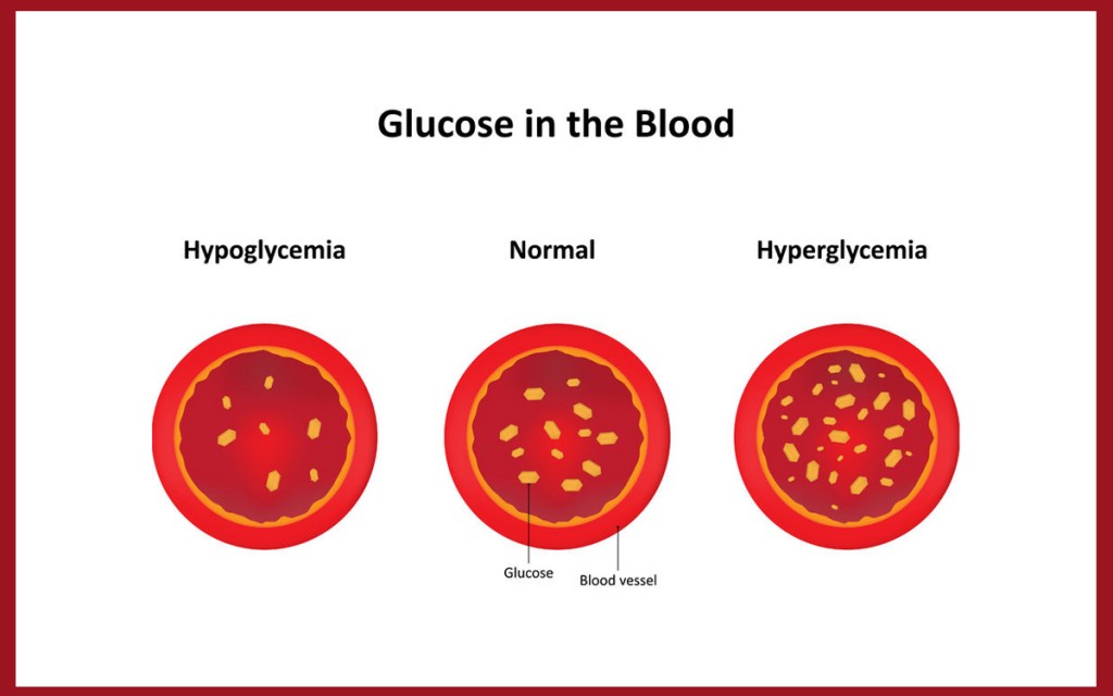It is important to know the difference between high and low blood sugars so you can treat them properly