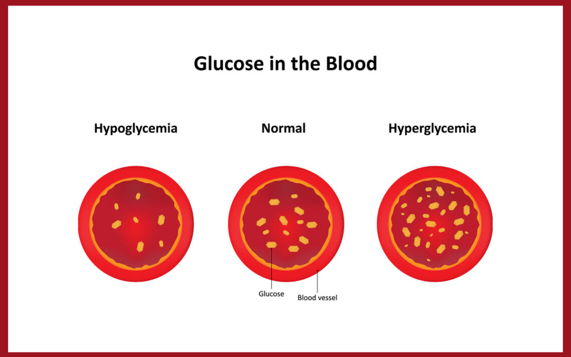 It is important to know the difference between high and low blood sugars so you can treat them properly