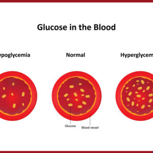 What is hypoglycemia?