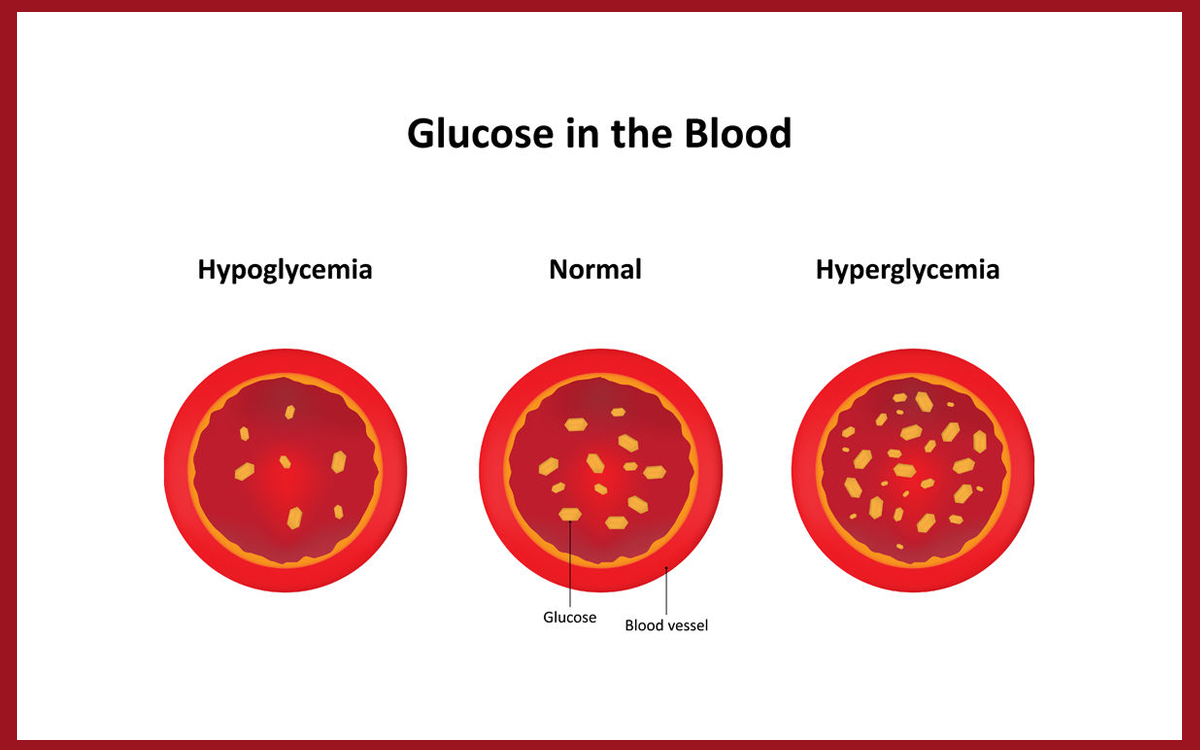 It is important to know the difference between high and low blood sugars so you can treat them properly