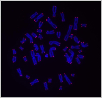 Micrograph of human chromosomes with telomeres appearing in pink. Courtesy Mary Armanios, M.D. 